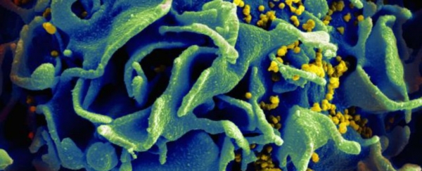 Các nhà khoa học tìm ra phương pháp diệt tận gốc virus HIV